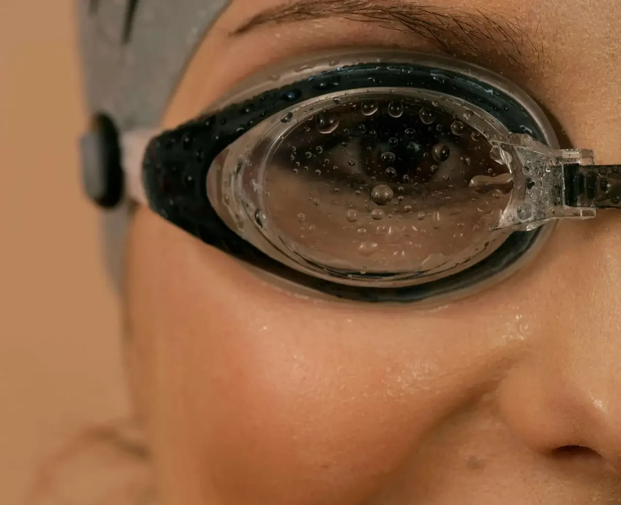 Chirurgie réfractive Dinan Josselin